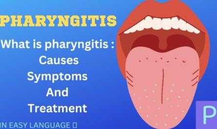What is pharyngitis : causes, symptoms, treatment