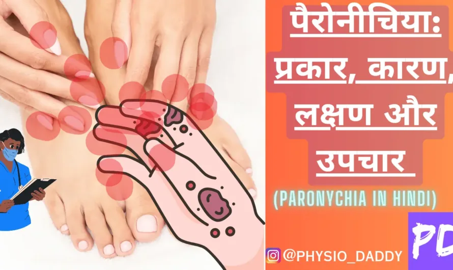 पैरोनीचिया: प्रकार, कारण, लक्षण और उपचार (Paronychia in hindi)
