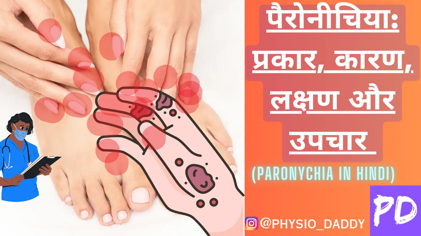 पैरोनीचिया: प्रकार, कारण, लक्षण और उपचार (Paronychia in hindi)