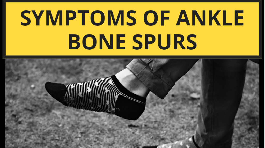 Symptoms of Ankle Bone Spurs