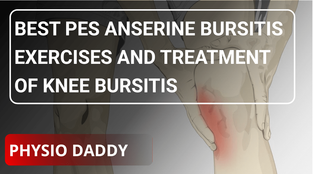 Best Pes anserine bursitis Exercises and Treatment of knee bursitis