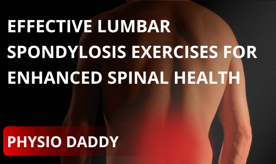 Effective Lumbar Spondylosis Exercises for Enhanced Spinal Health